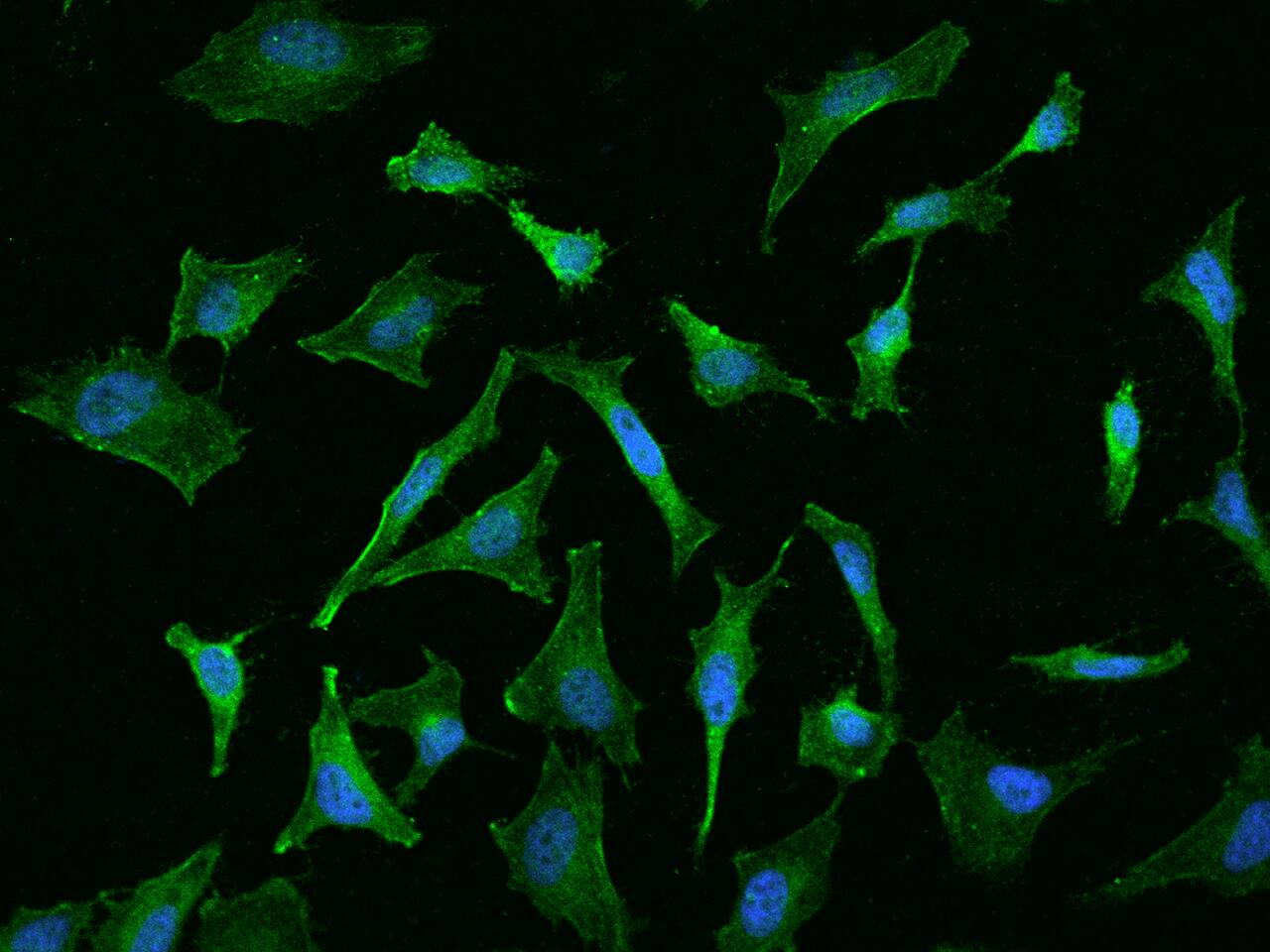 FLRT1 Antibody - BSA Free