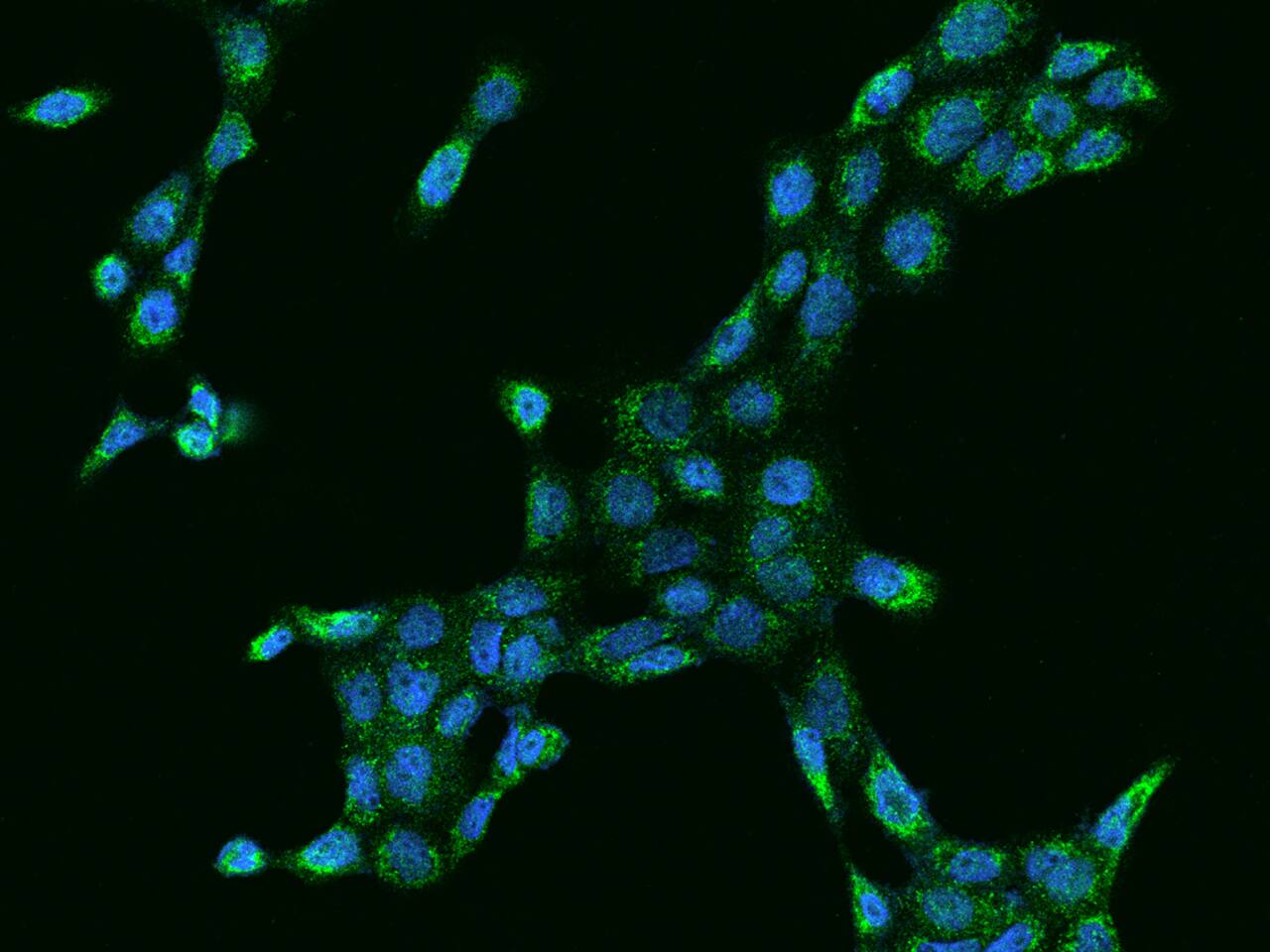 MCCC2 Antibody - BSA Free