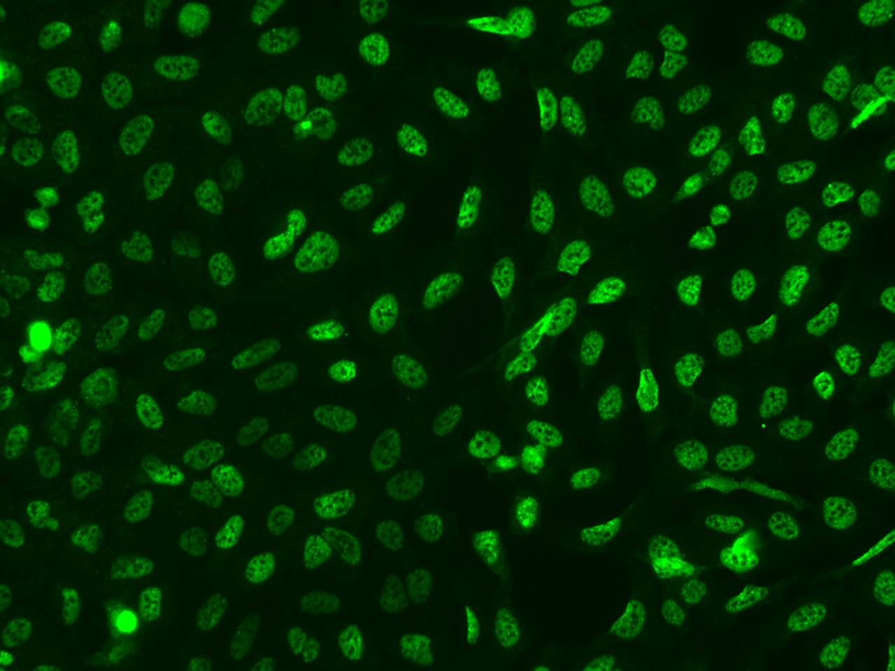 TTC33 Antibody - BSA Free