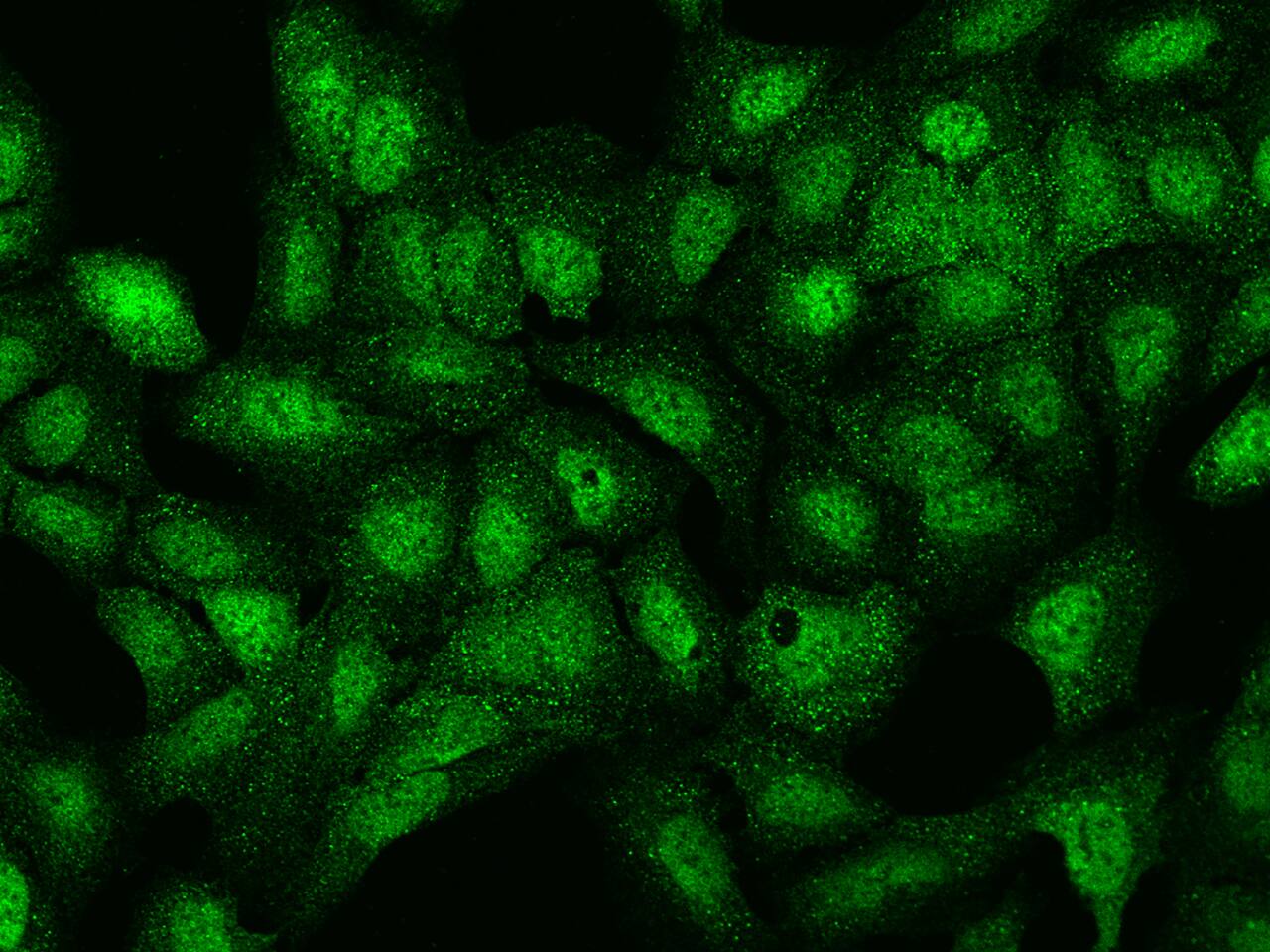 LRWD1 Antibody - BSA Free