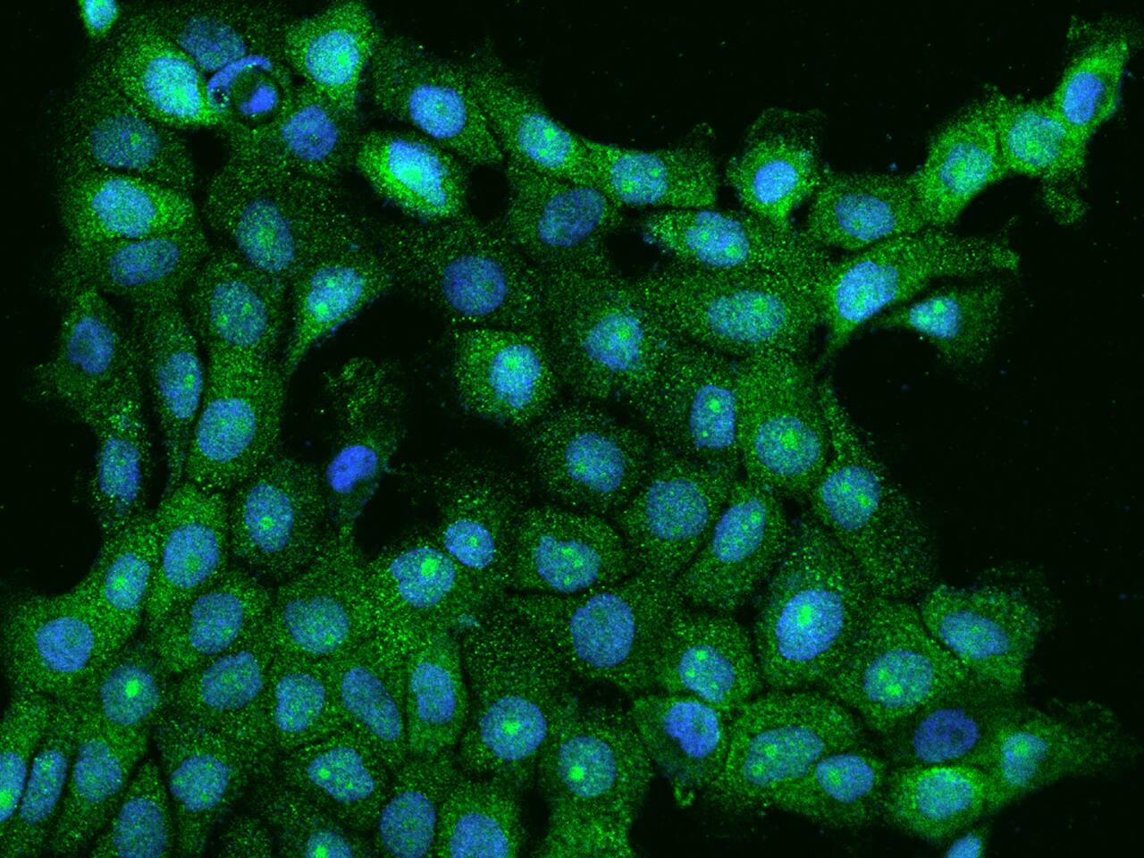 ANKMY1 Antibody - BSA Free