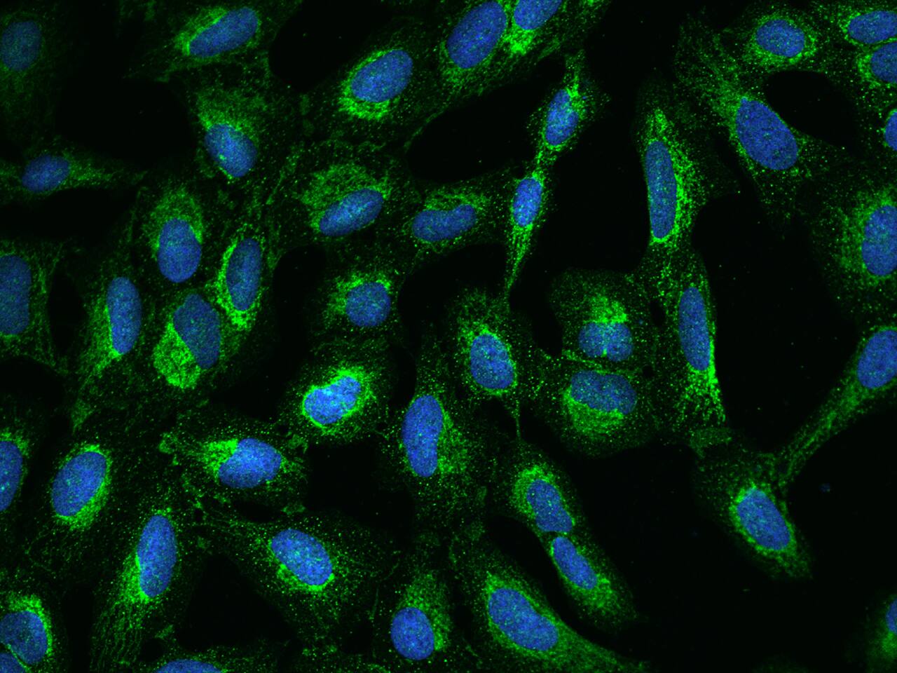 UQCRC2 Antibody - BSA Free