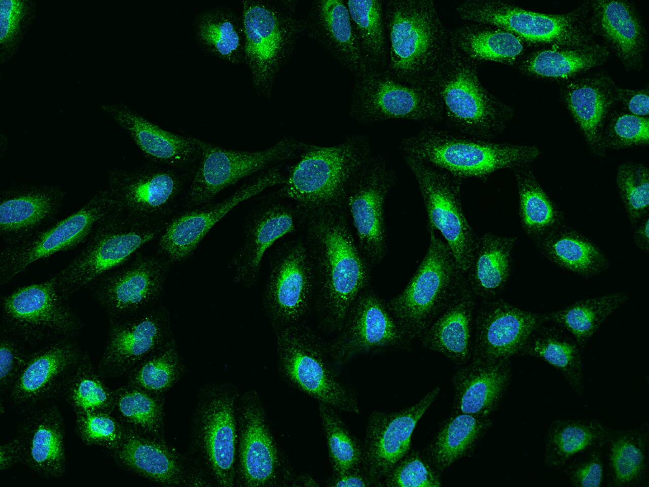 Derlin 1 Antibody - BSA Free