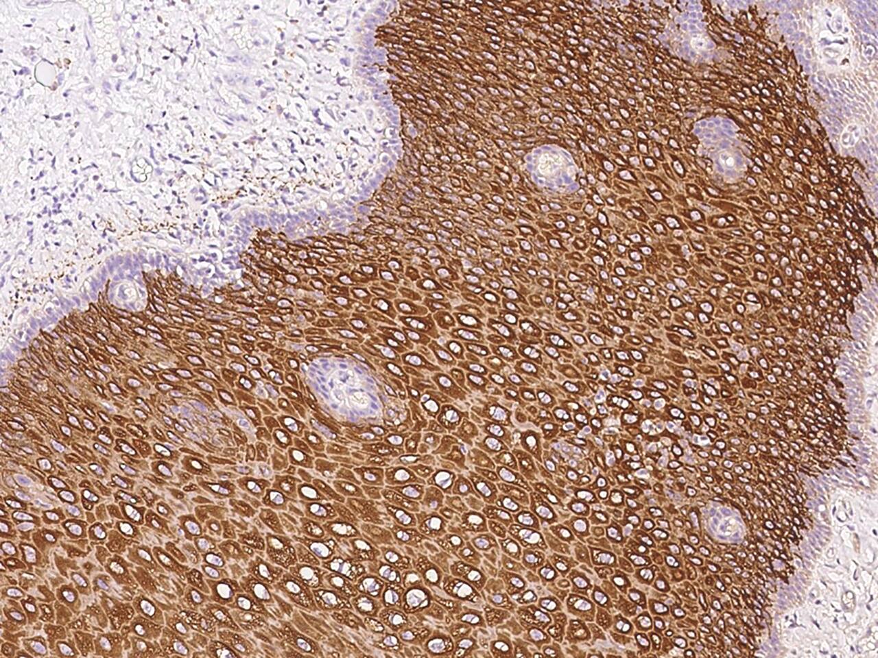 Cytokeratin 6a Antibody - BSA Free