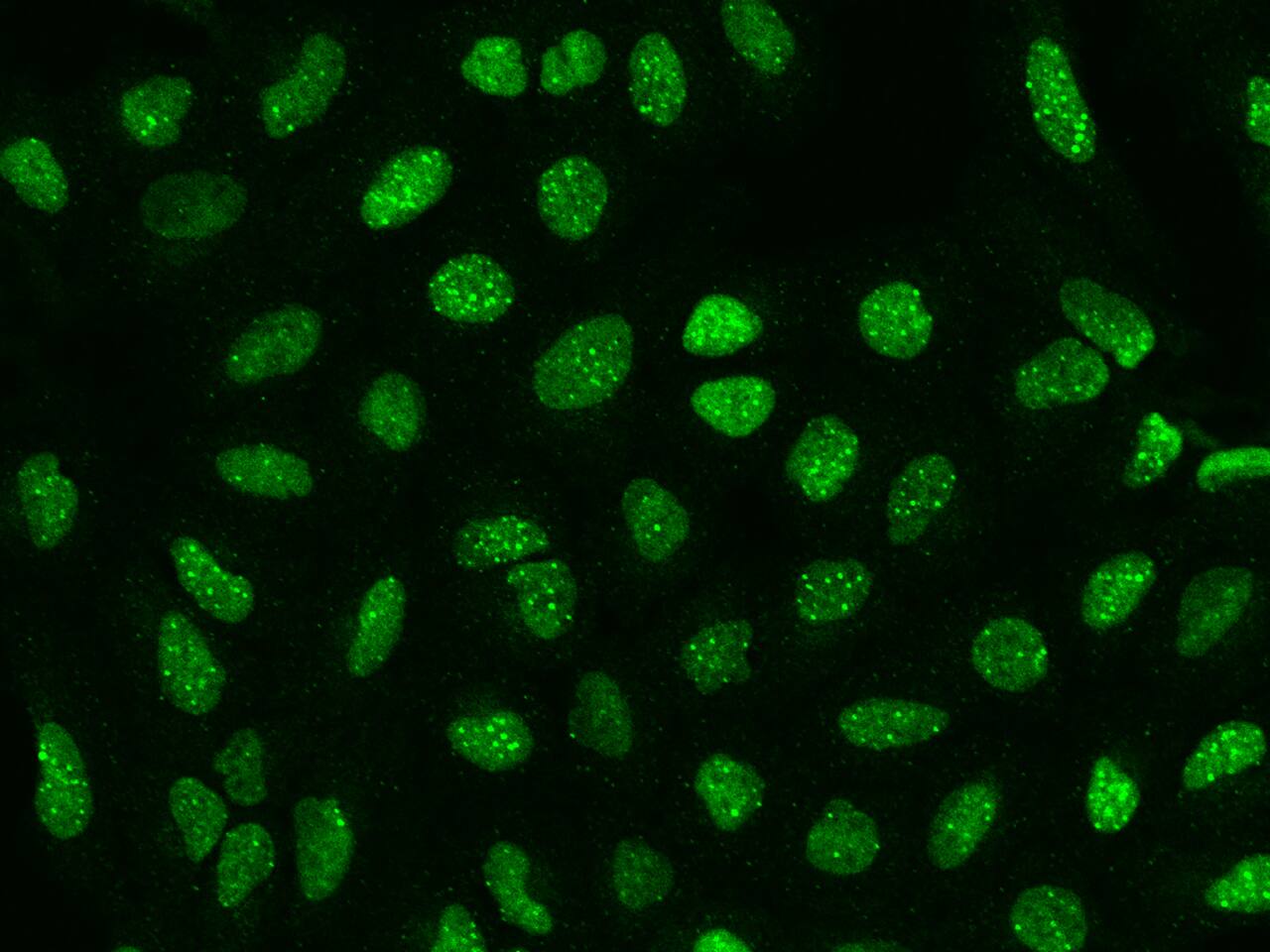 SP100 Antibody - BSA Free