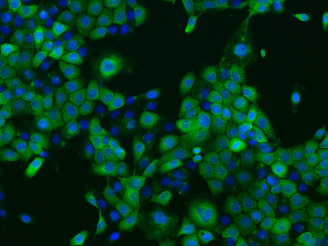 PPP2R1B Antibody - BSA Free