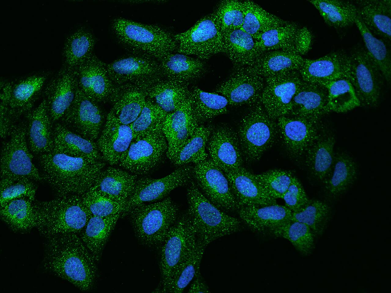 RPIP8 Antibody - BSA Free