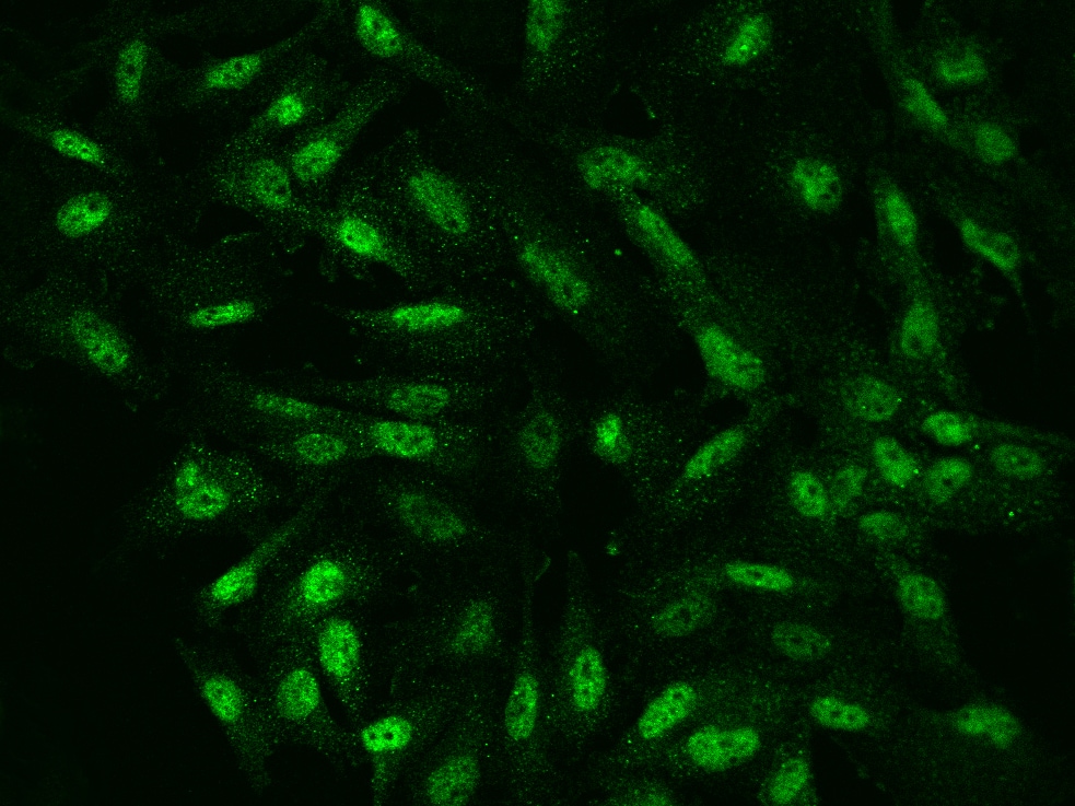 NKX6.1 Antibody - BSA Free