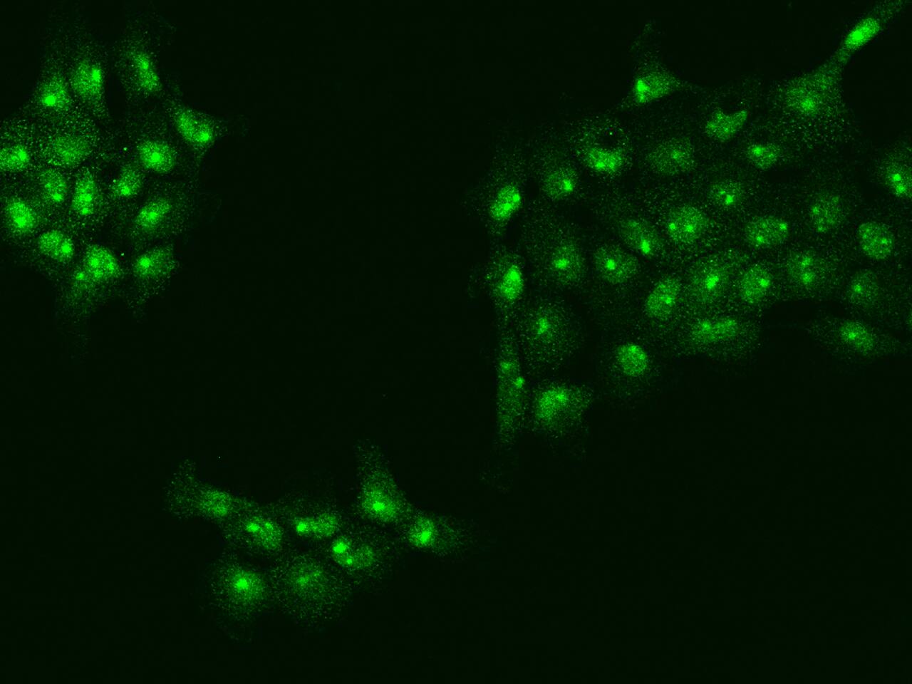 UTP18 Antibody - BSA Free