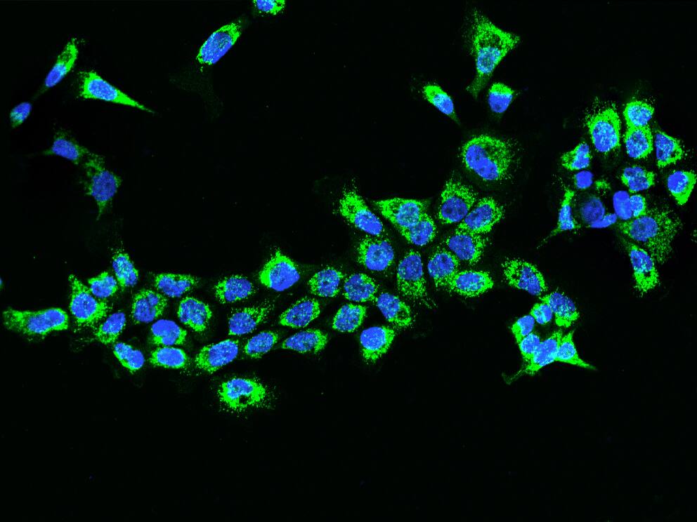 ETFB Antibody - BSA Free