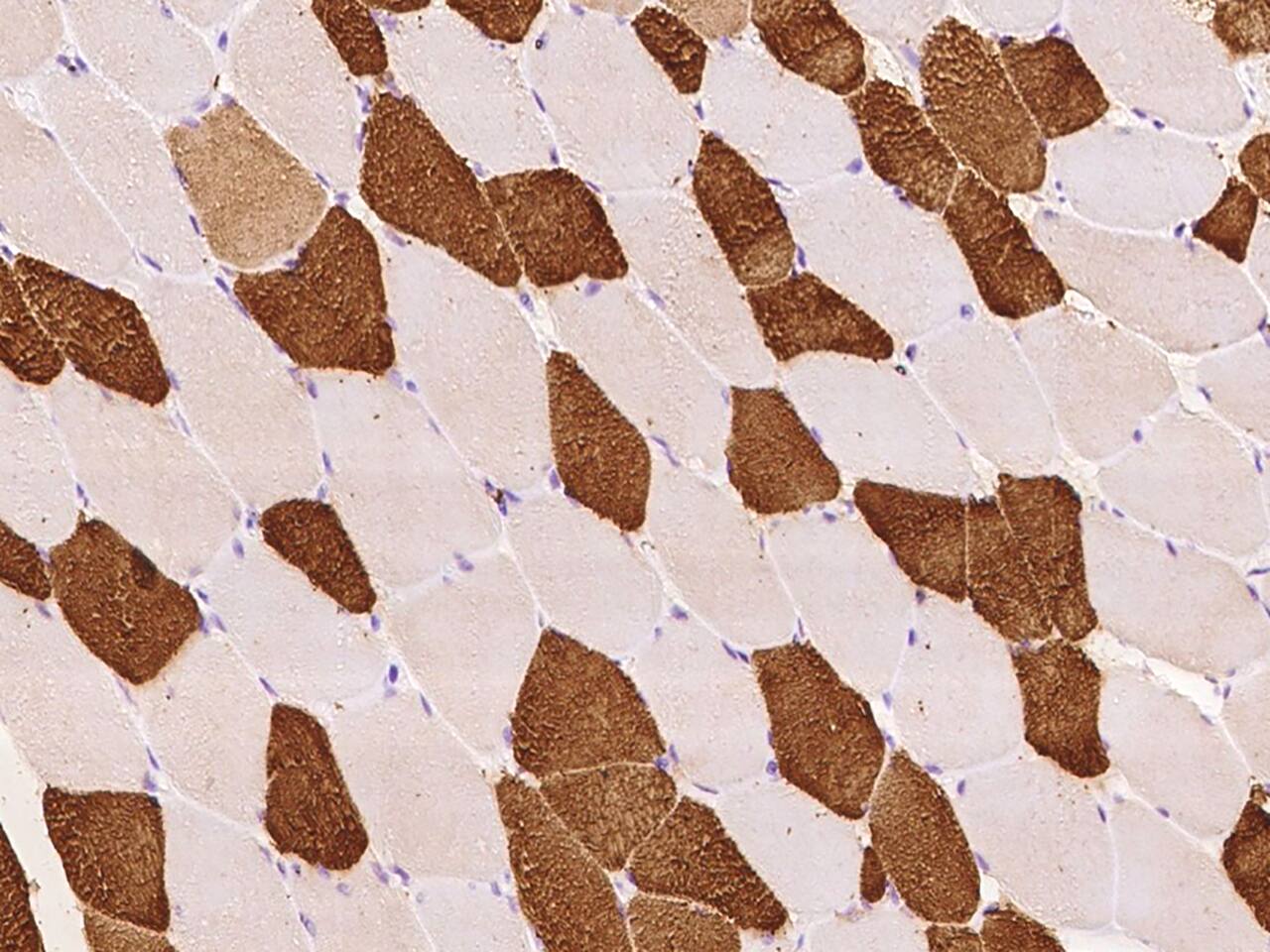 Troponin T Type 3 (fast skeletal) Antibody - BSA Free