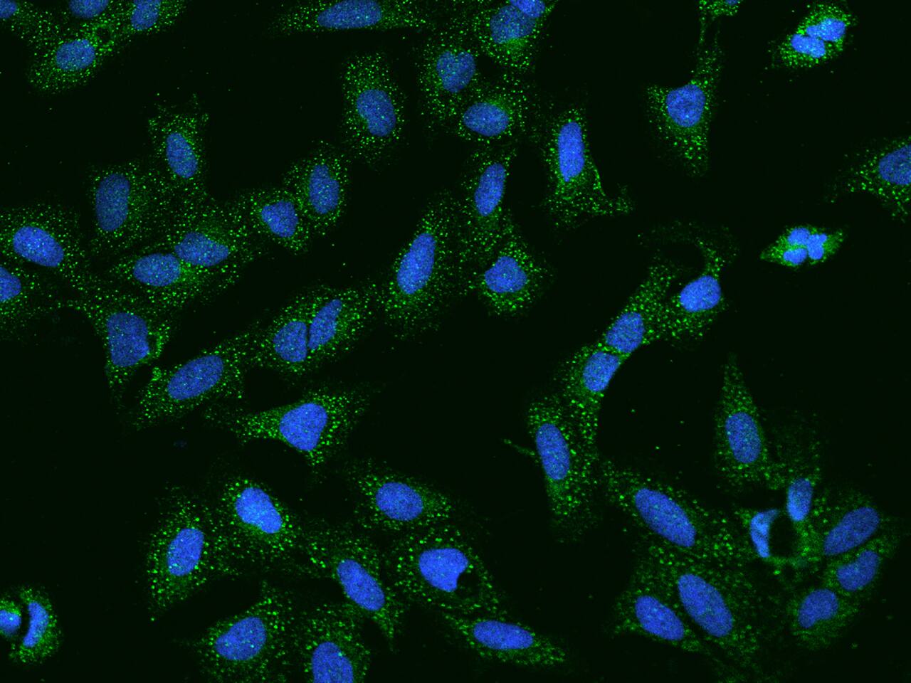 SCCPDH Antibody - BSA Free