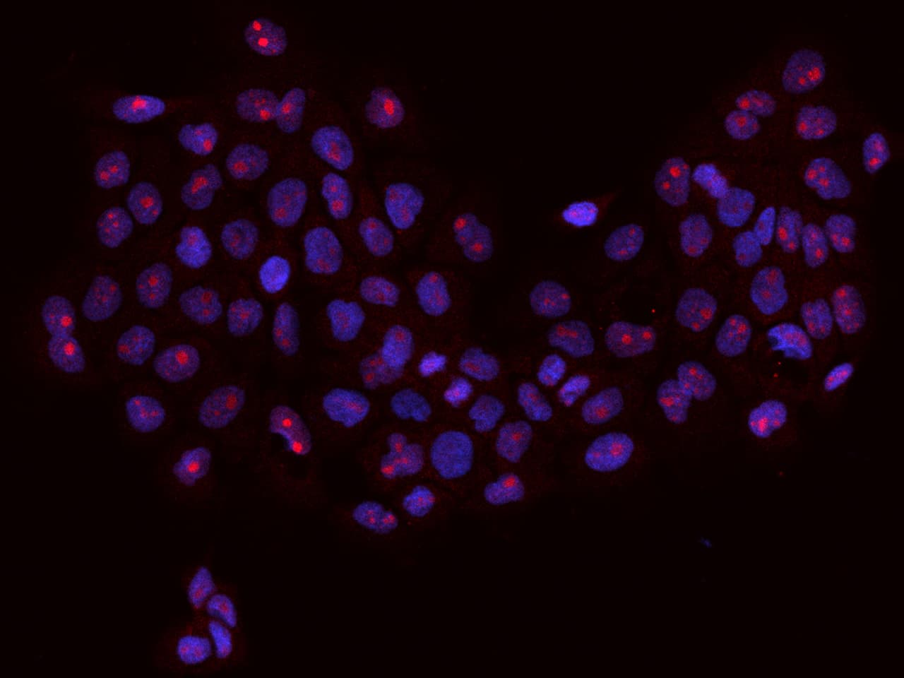 RBM34 Antibody - BSA Free