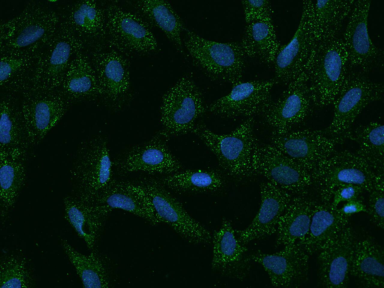 SLC35G2 Antibody - BSA Free