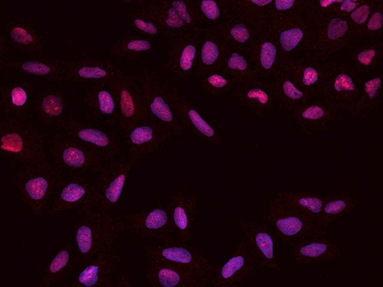 PAPSS1 Antibody - BSA Free