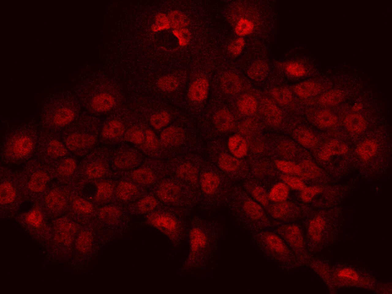 PHTF2 Antibody - BSA Free