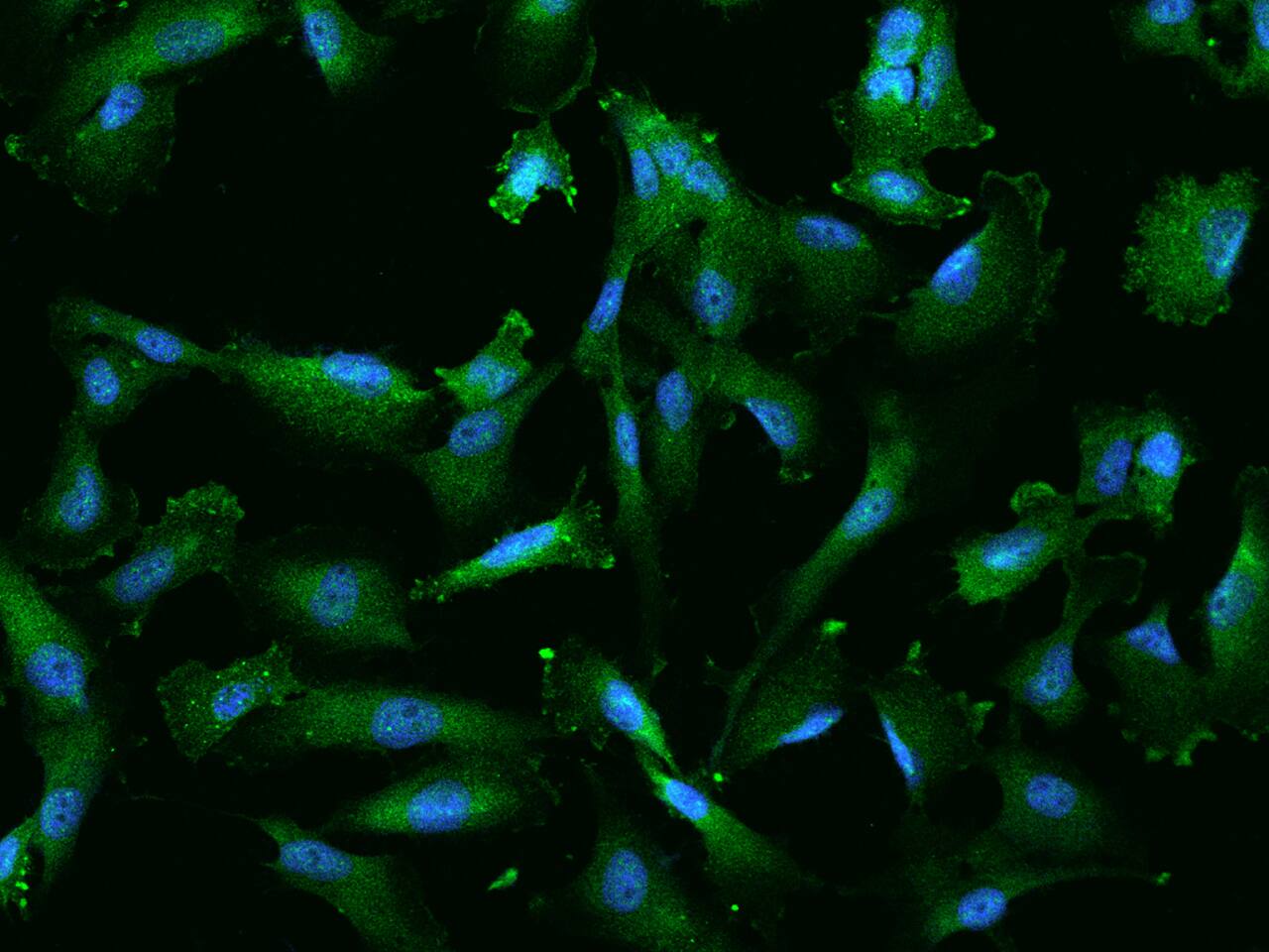 PYGL Antibody - BSA Free