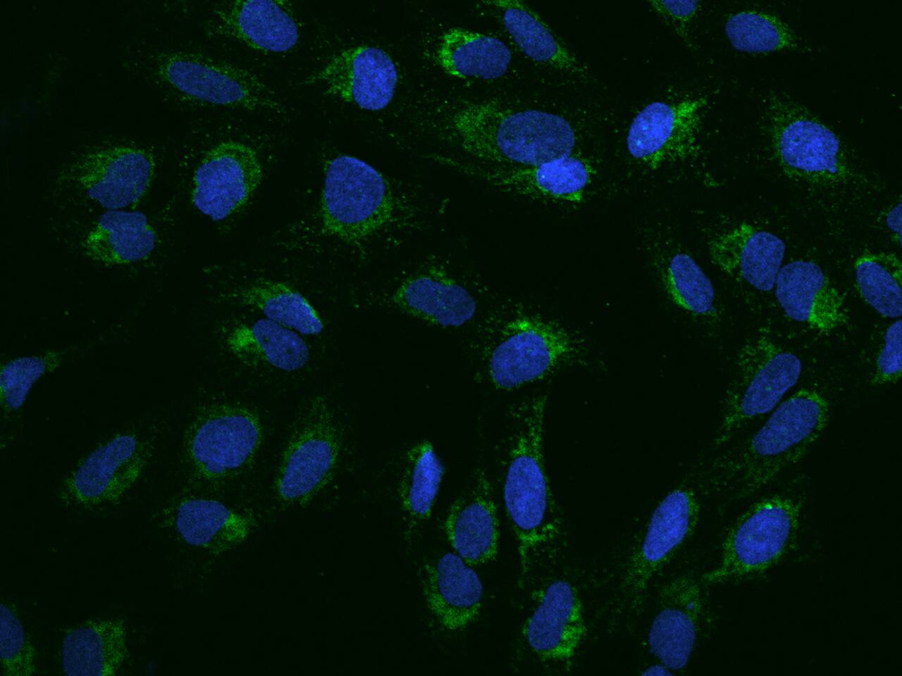 PNPT1 Antibody - BSA Free