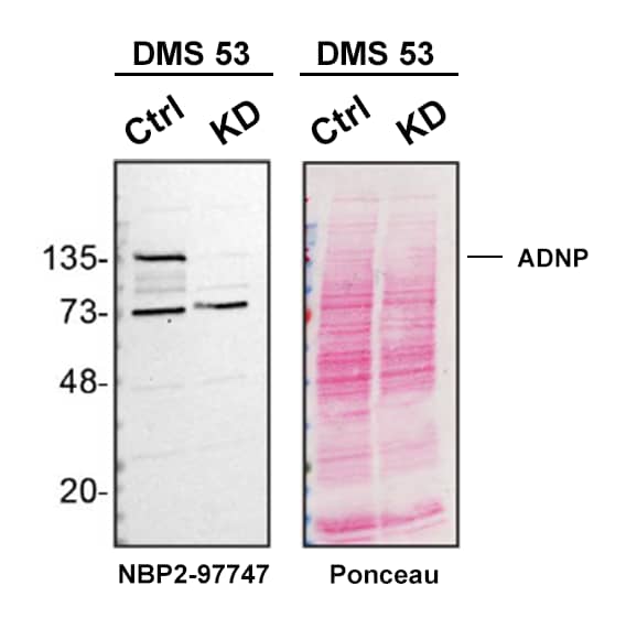 ADNP Antibody