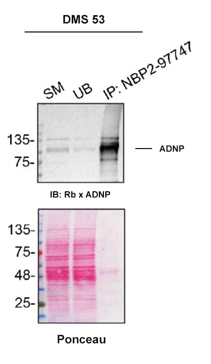 ADNP Antibody