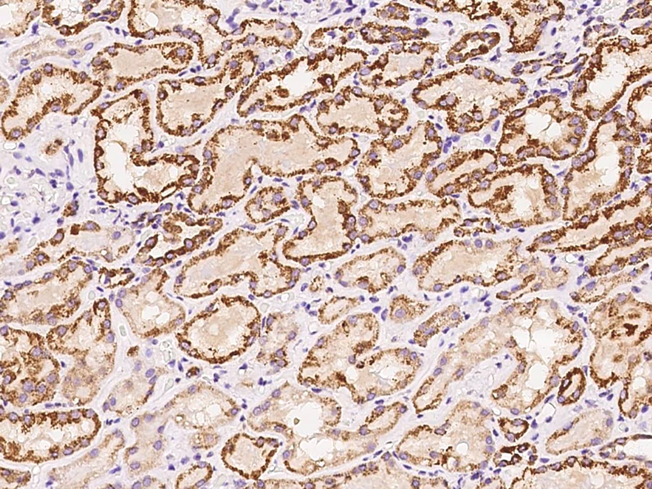 HSDL2 Antibody - BSA Free