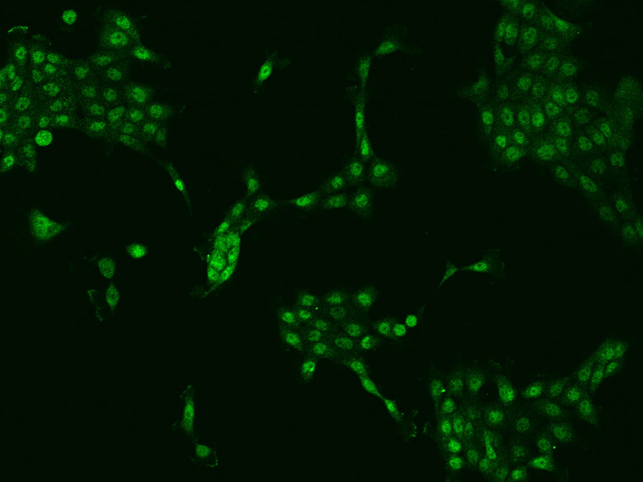 ZNF251 Antibody - BSA Free