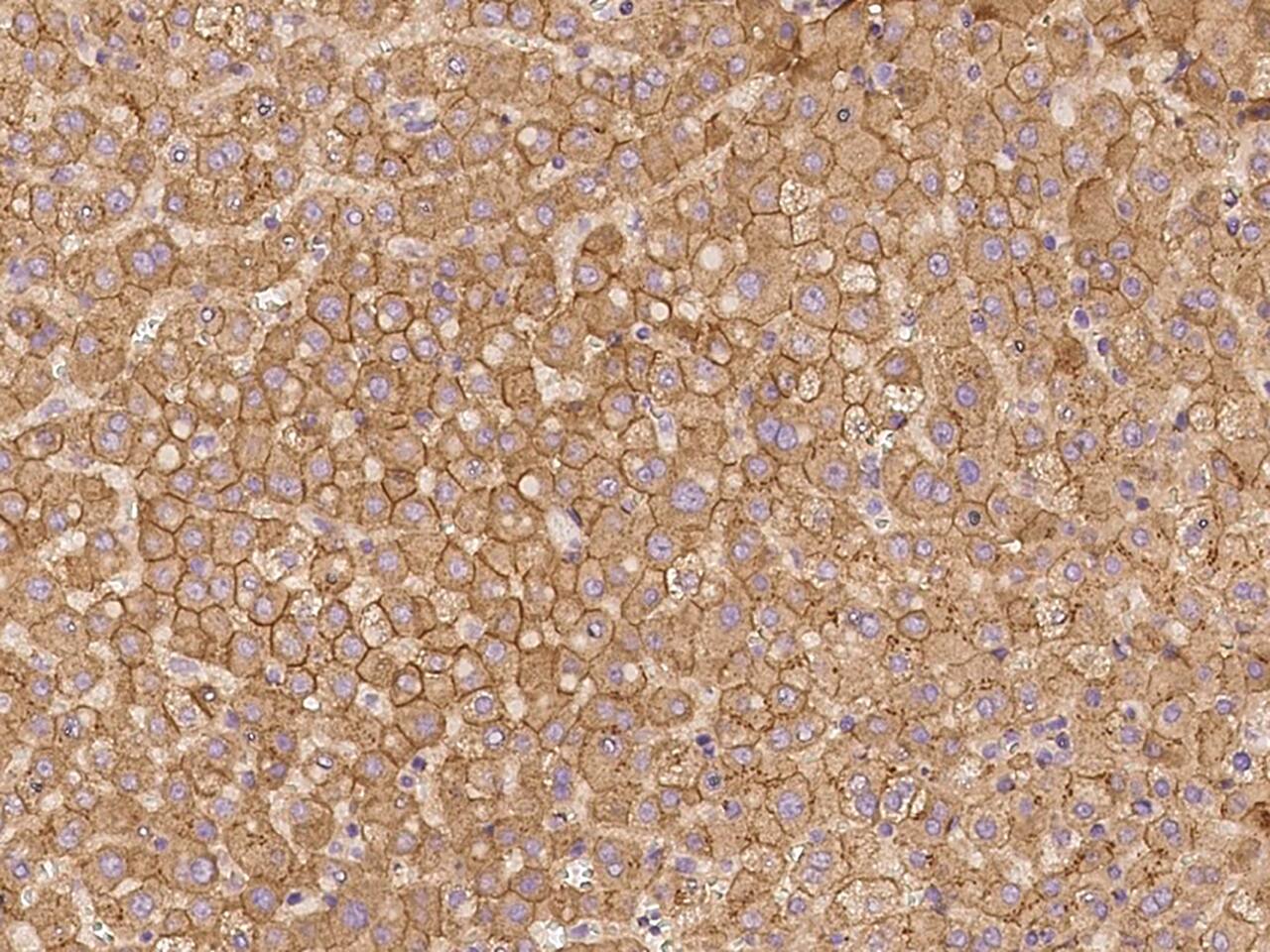 ZNF248 Antibody - BSA Free