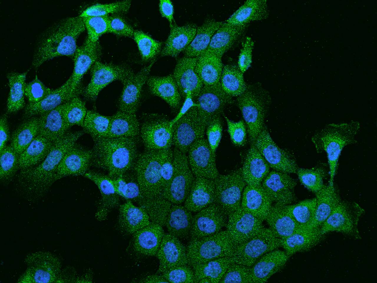 PI 4 Kinase type 2 beta Antibody - BSA Free