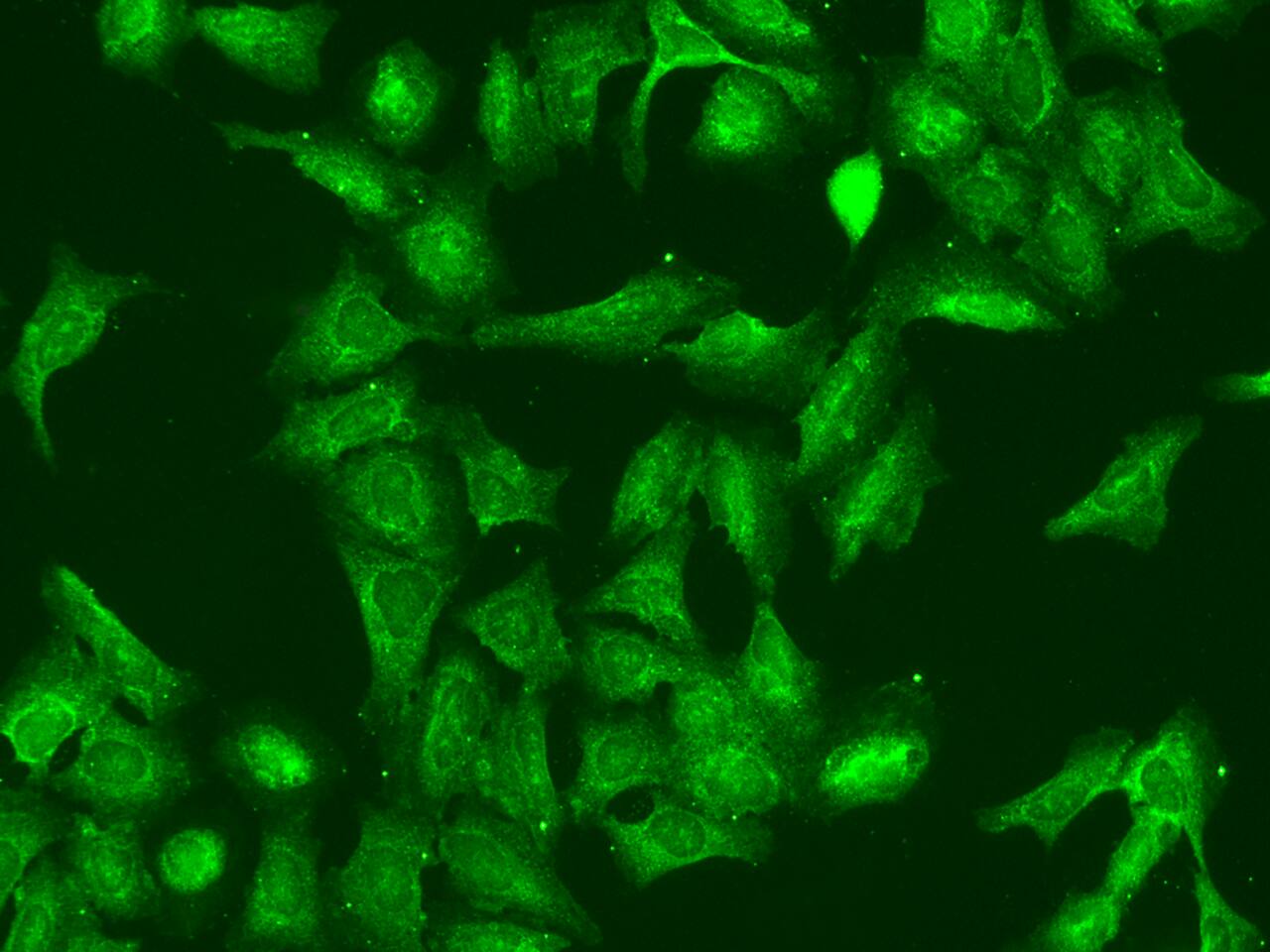 RGS5 Antibody - BSA Free