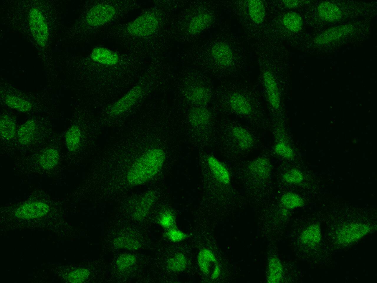 ARHGAP22 Antibody - BSA Free