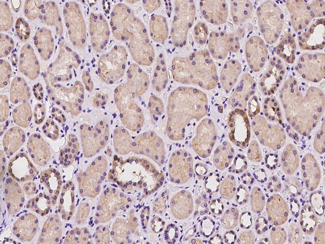 SUCLG2 Antibody