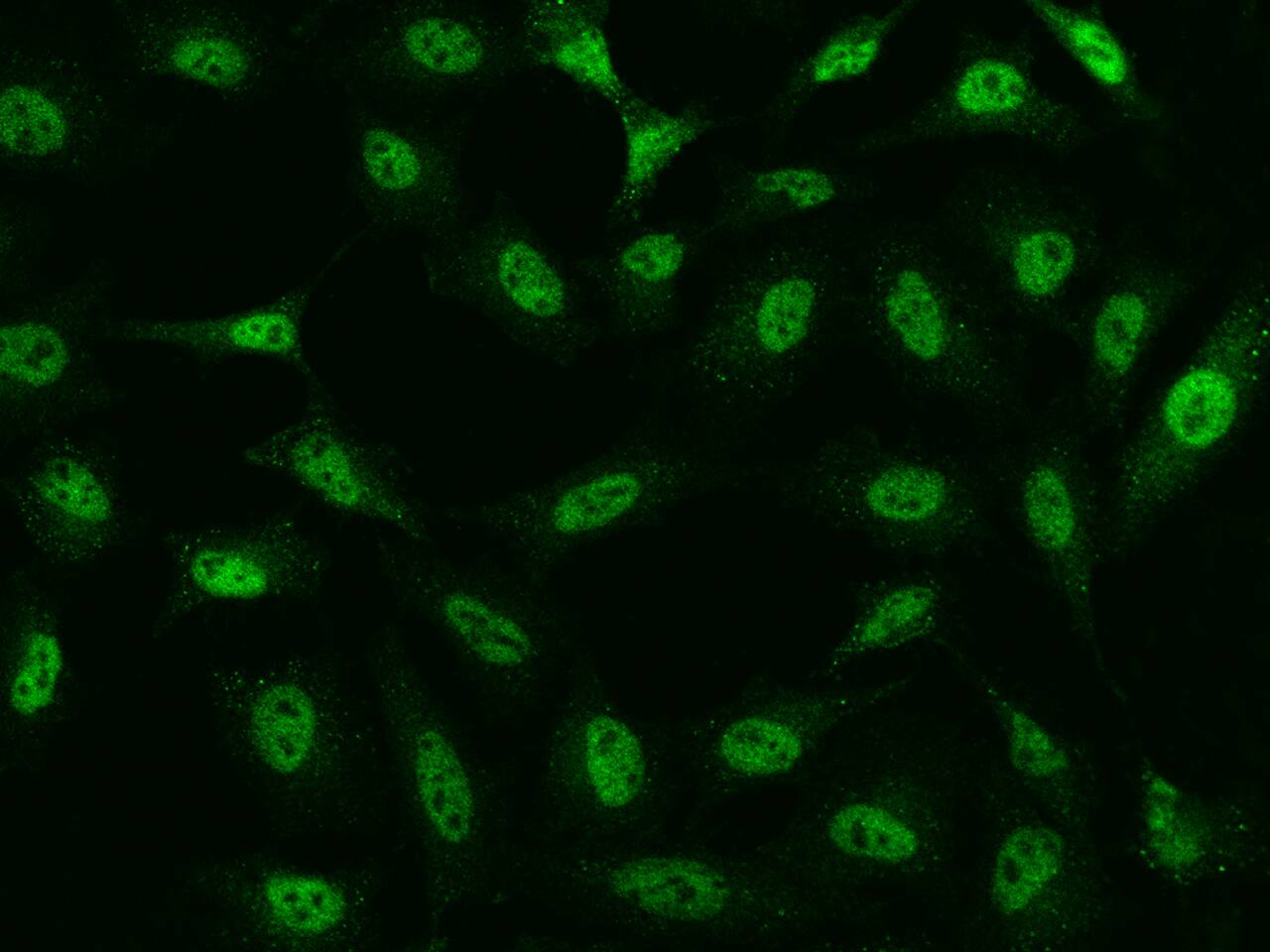 TATDN1 Antibody - BSA Free