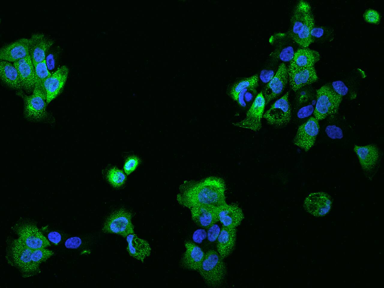 PHLDB2 Antibody - BSA Free