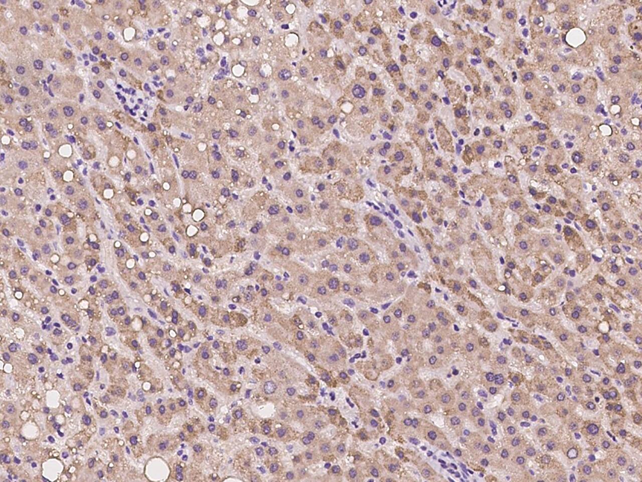 SPICE1 Antibody - BSA Free