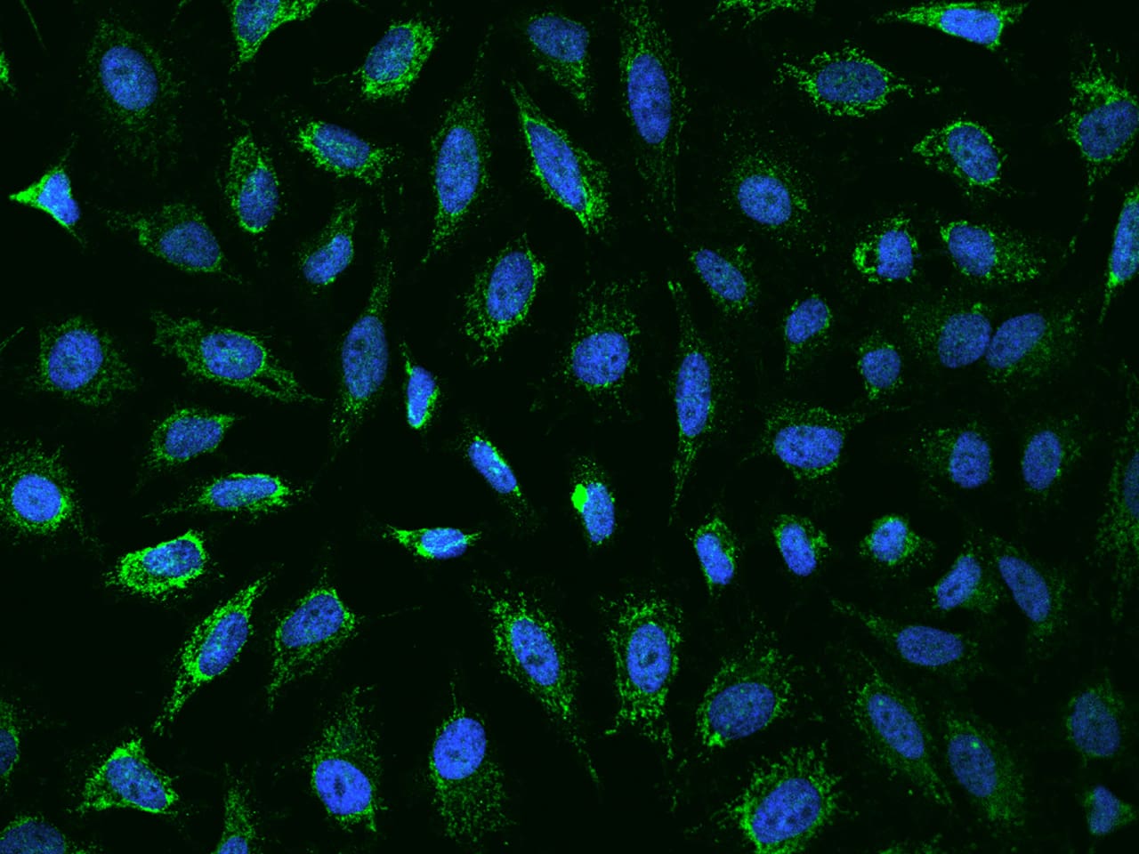 Ankyrin Repeat Domain 33B Antibody - BSA Free