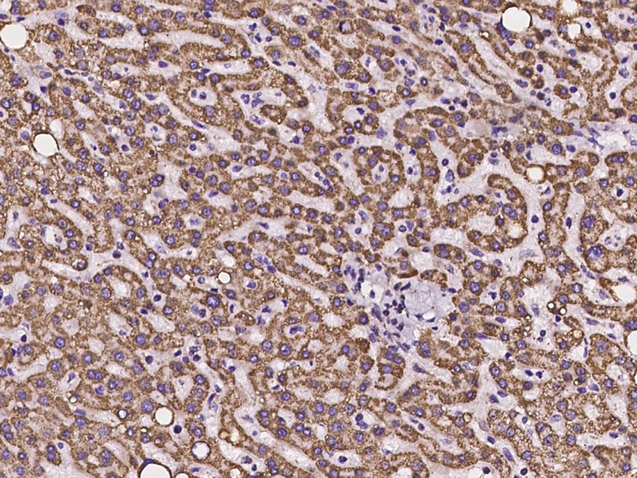 Ankyrin Repeat Domain 33B Antibody - BSA Free