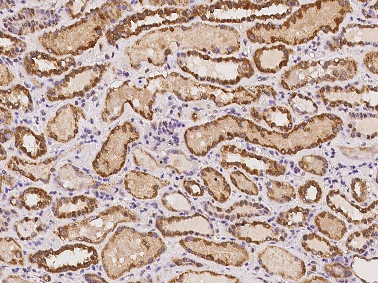 C20orf96 Antibody - BSA Free