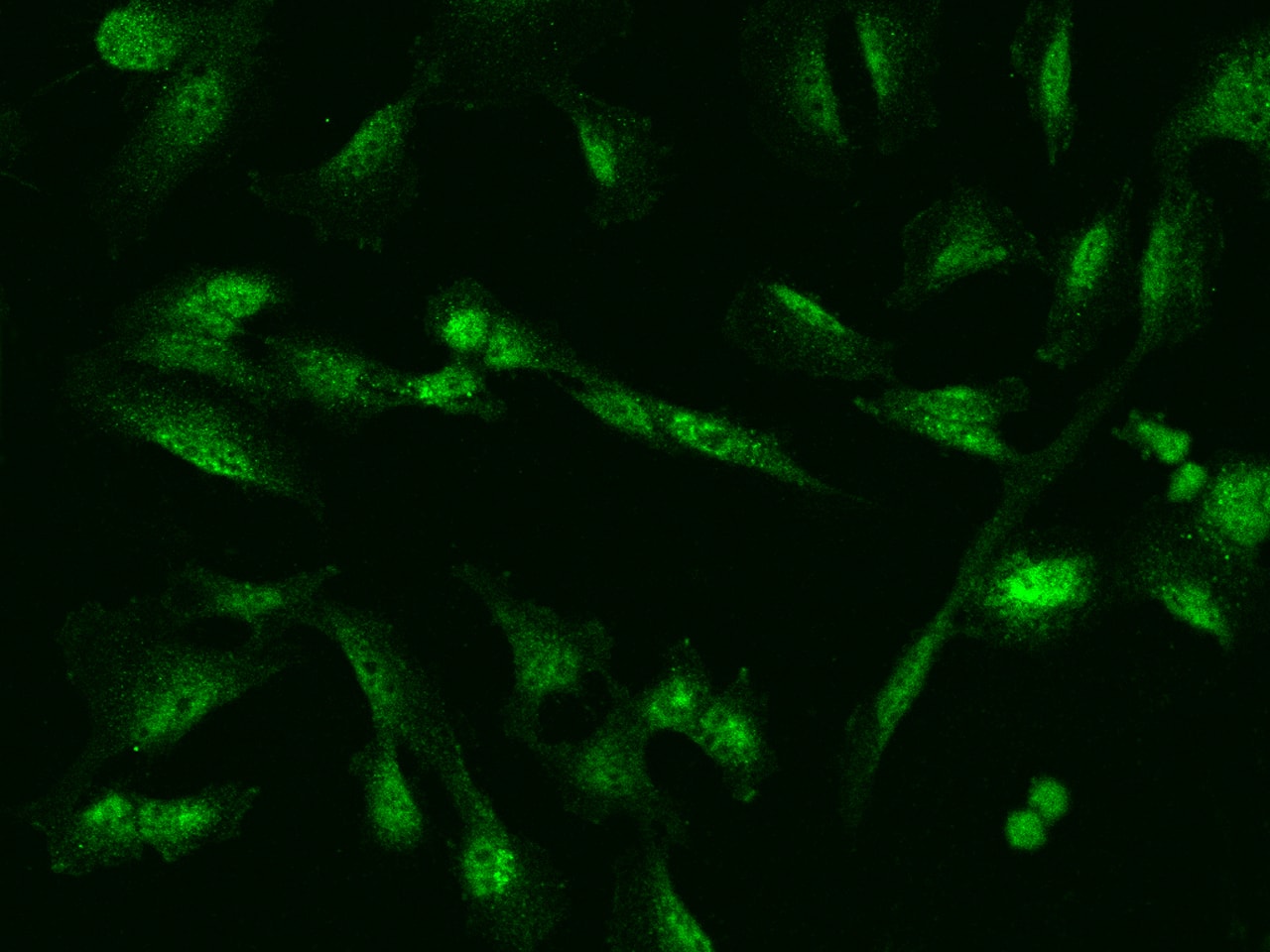ZNF282 Antibody - BSA Free