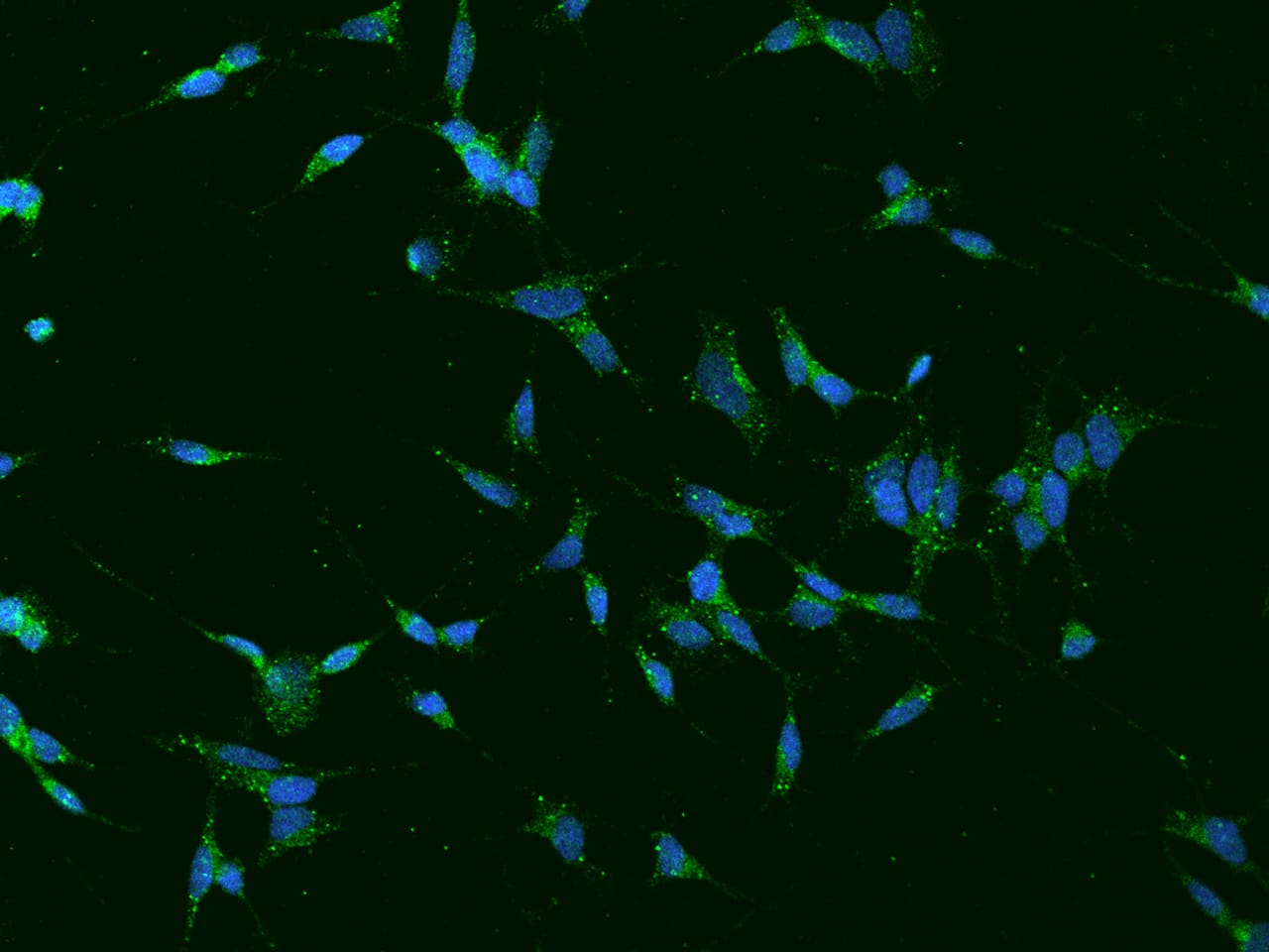TVP23A Antibody - BSA Free