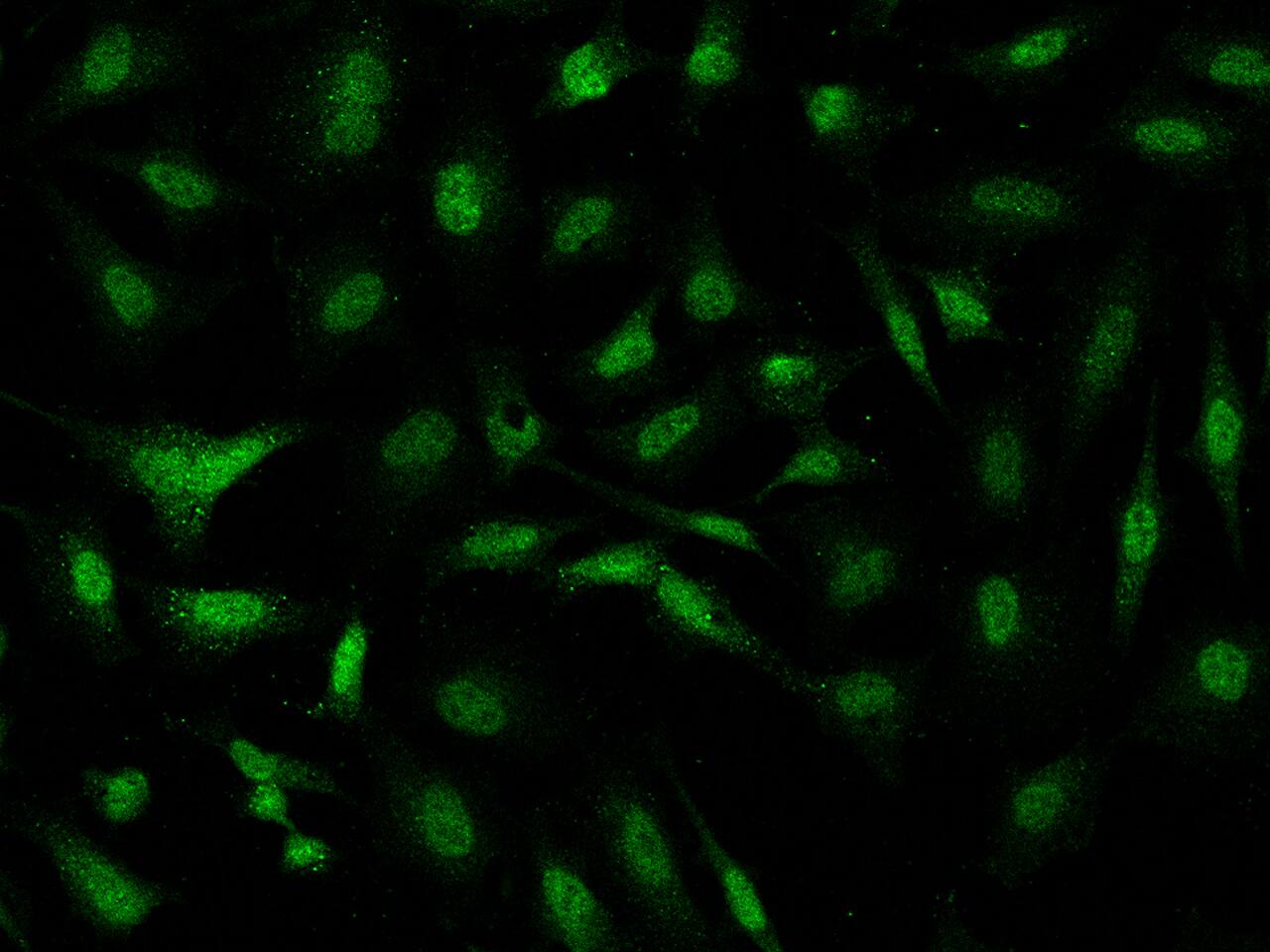 PGBD4 Antibody - BSA Free