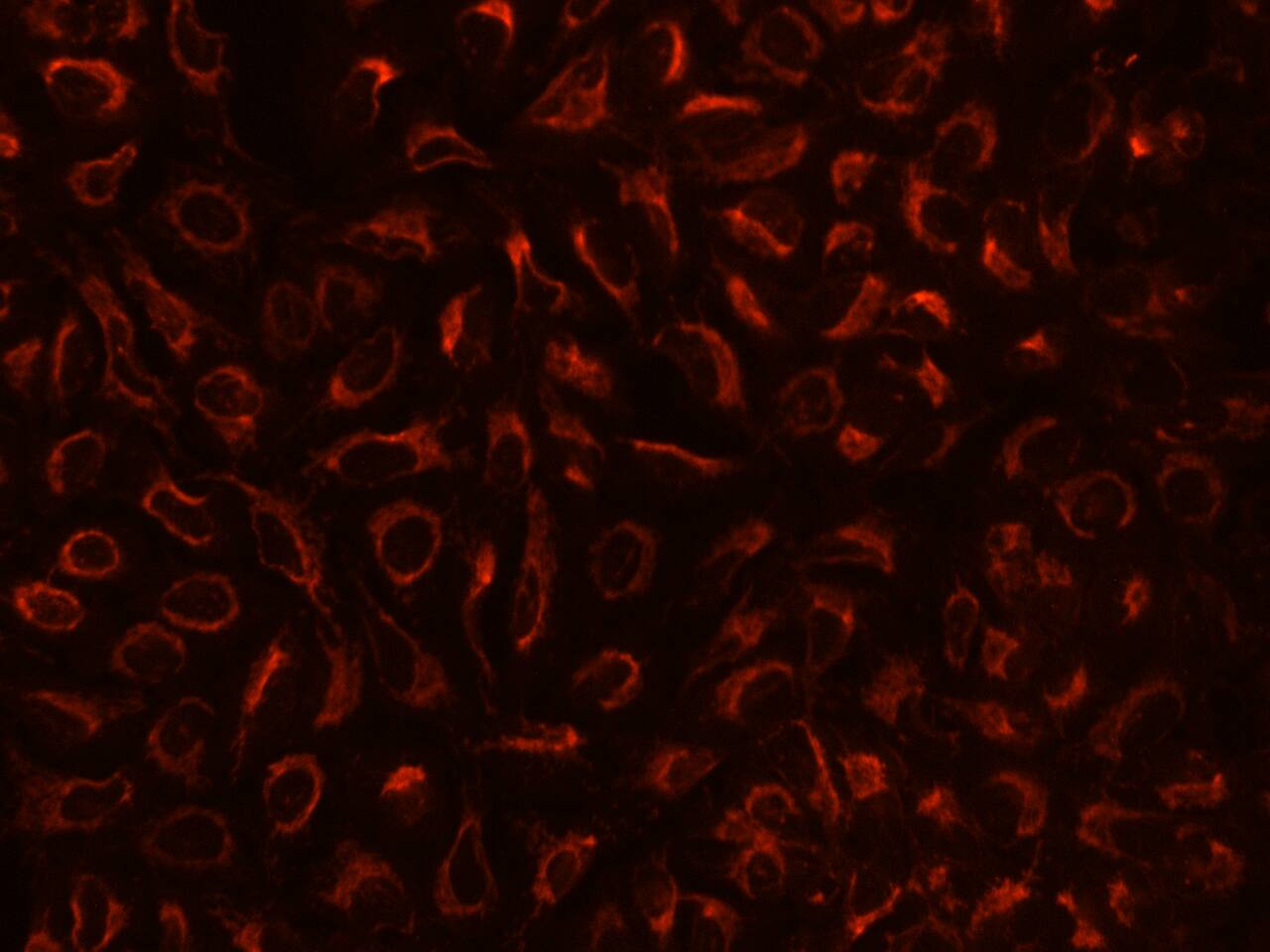 TBRG4 Antibody - BSA Free