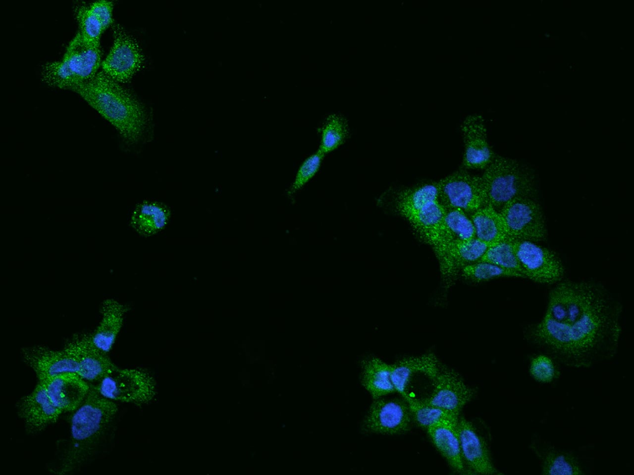 UBAP1 Antibody - BSA Free