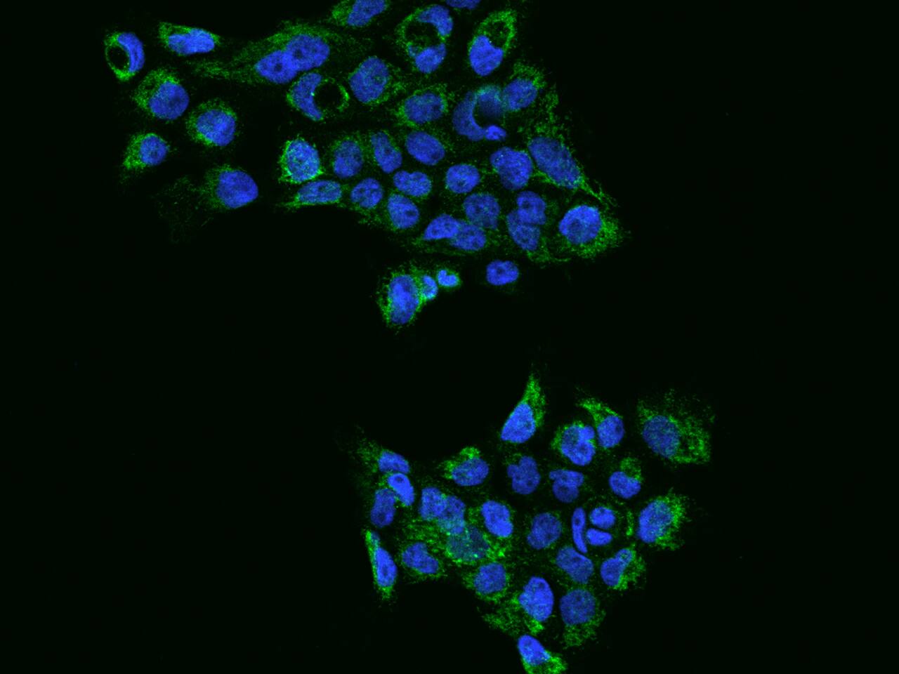 TST Antibody - BSA Free