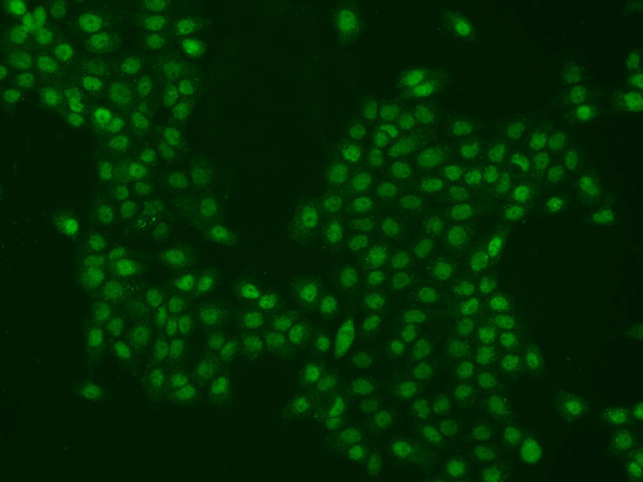 PPHLN1 Antibody - BSA Free