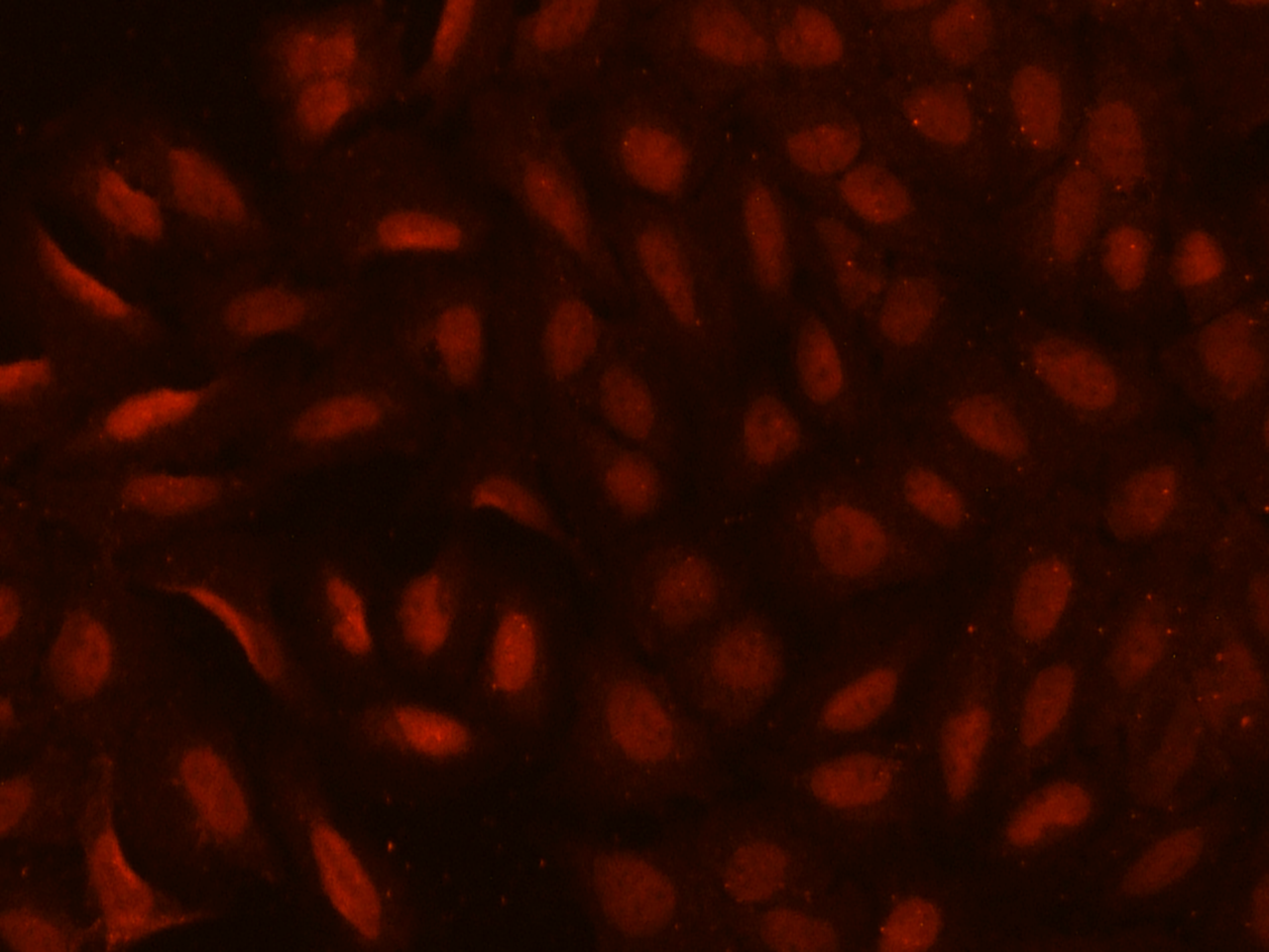 CDYL Antibody - BSA Free