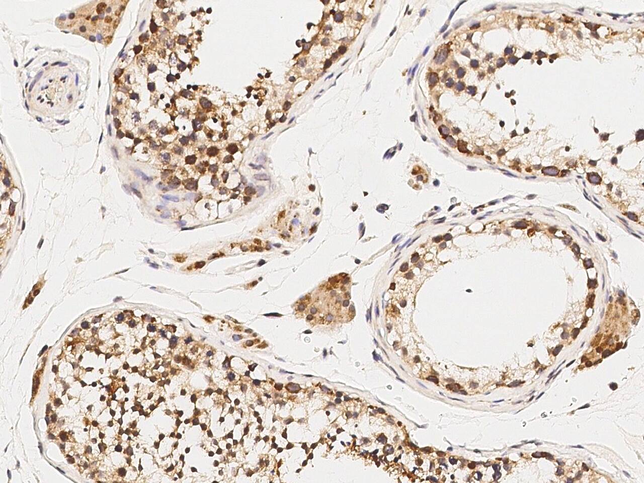 STRA8 Antibody