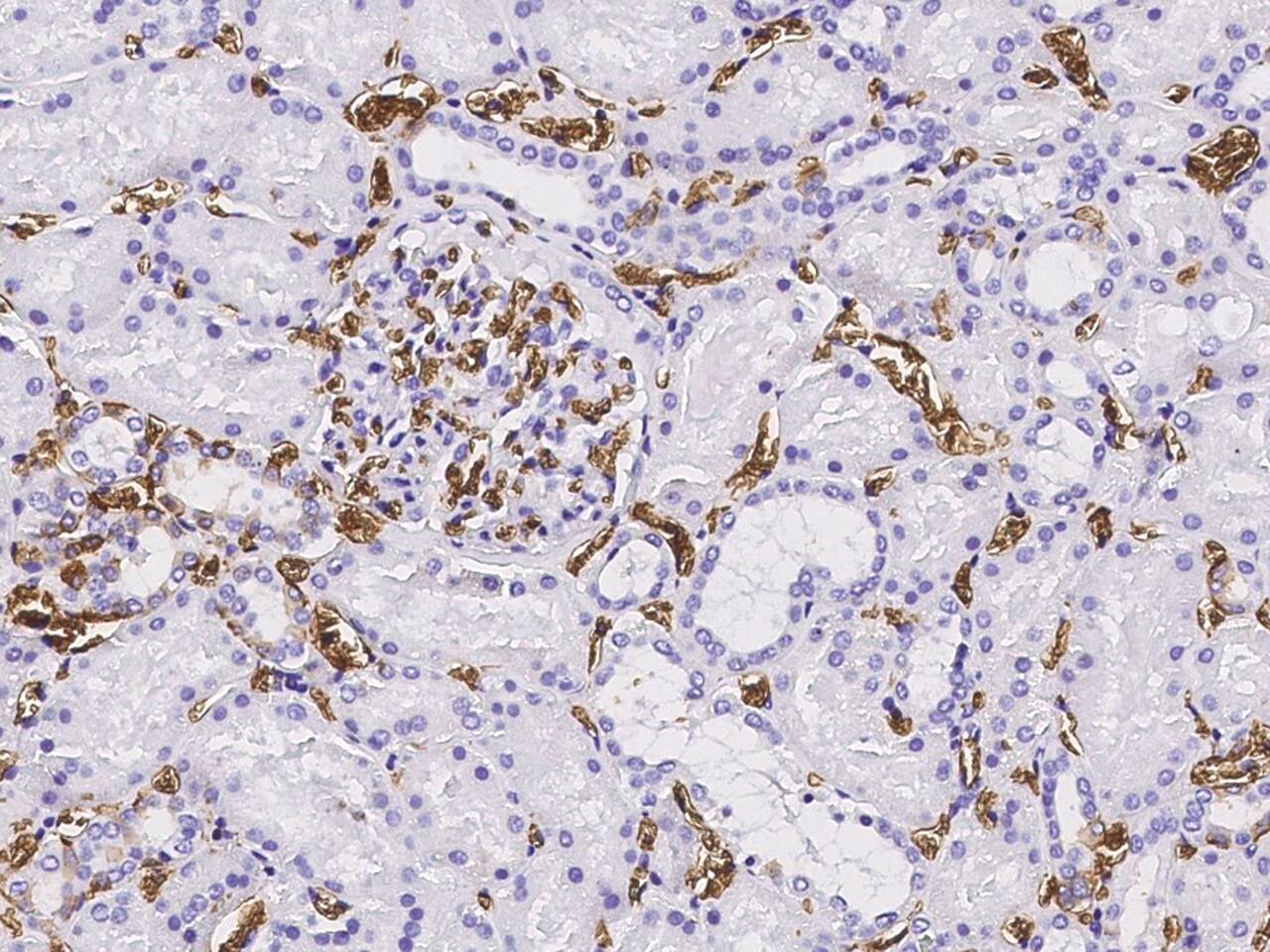 Band 3 Antibody - Azide and BSA Free