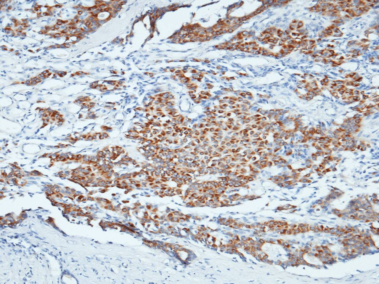 NANOS1 Antibody - Azide and BSA Free