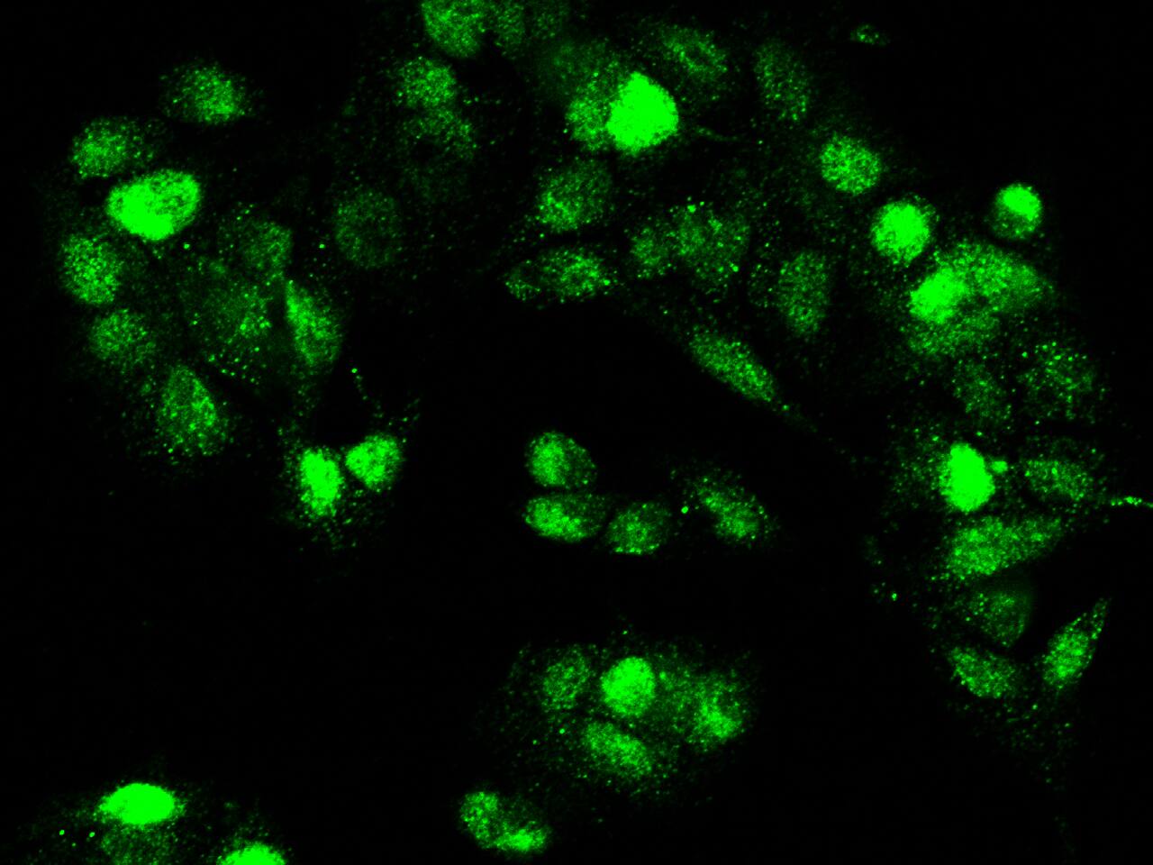 HMGA2 Antibody - Azide and BSA Free