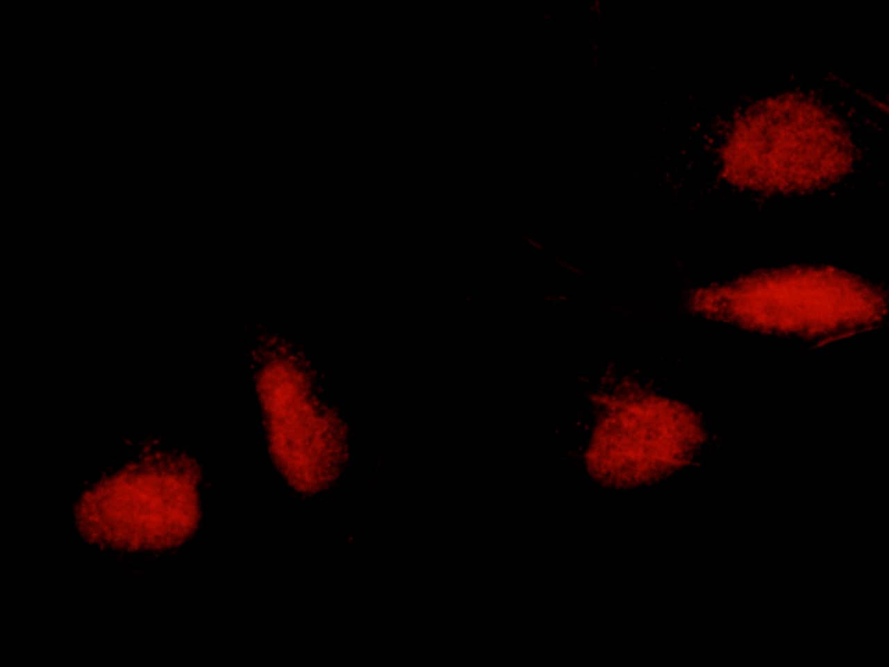 ERCC8 Antibody - Azide and BSA Free